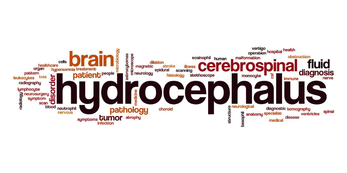 hydrocephalus